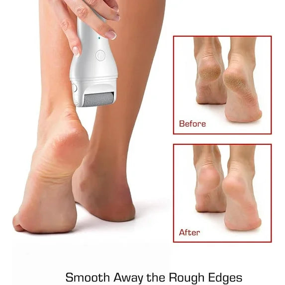 Red by Kiss electric foot callus remover. FCR01